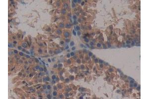 IHC-P analysis of Mouse Testis Tissue, with DAB staining. (MAPKAP Kinase 2 抗体  (AA 117-337))