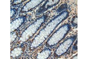 IHC-P analysis of Human Rectum Tissue, with DAB staining. (CHI3L1 抗体  (AA 112-377))