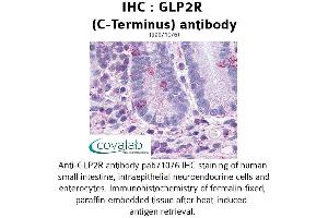Image no. 1 for anti-Glucagon-Like Peptide 2 Receptor (GLP2R) (C-Term) antibody (ABIN1734731) (GLP2R 抗体  (C-Term))