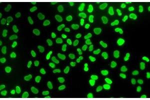 Immunofluorescence analysis of U2OS cells using TMPO Polyclonal Antibody (Thymopoietin 抗体)