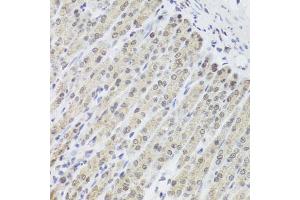 Immunohistochemistry of paraffin-embedded mouse stomach using FANCL antibody. (FANCL 抗体)