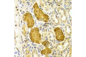 Immunohistochemistry (IHC) image for anti-Protein Kinase C, epsilon (PRKCE) (AA 488-737) antibody (ABIN3022942)