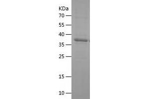 Western Blotting (WB) image for Decorin (DCN) (AA 36-195) protein (His-IF2DI Tag) (ABIN7122609) (Decorin Protein (DCN) (AA 36-195) (His-IF2DI Tag))