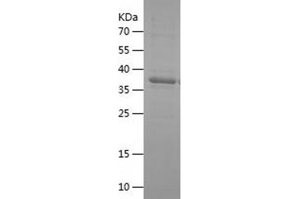 Decorin Protein (DCN) (AA 36-195) (His-IF2DI Tag)