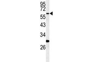 Western Blotting (WB) image for anti-Receptor-Interacting serine-threonine Kinase 3 (RIPK3) (AA 489-518) antibody (ABIN3032450)