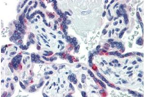 Human Placenta (formalin-fixed, paraffin-embedded) stained with SIN3A antibody ABIN462178 followed by biotinylated goat anti-rabbit IgG secondary antibody ABIN481713, alkaline phosphatase-streptavidin and chromogen. (SIN3A 抗体  (N-Term))