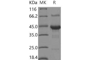 Western Blotting (WB) image for Shisa Homolog 3 (SHISA3) protein (Fc Tag) (ABIN7317032) (SHISA3 Protein (Fc Tag))