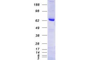 Validation with Western Blot