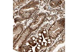 Immunohistochemical staining of human stomach with TAPBP polyclonal antibody  shows strong cytoplasmic and membranous positivity in glandular cells at 1:20-1:50 dilution.