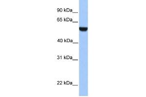 WB Suggested Anti-PHF17 Antibody Titration:  0. (PHF17 抗体  (C-Term))