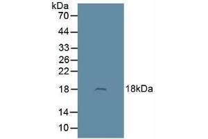 Detection of ADM in Rat Brain Tissue using Polyclonal Antibody to Adrenomedullin (ADM) (Adrenomedullin 抗体  (AA 22-147))