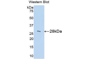 Western blot analysis of the recombinant protein. (IGFBP2 抗体  (AA 35-304))