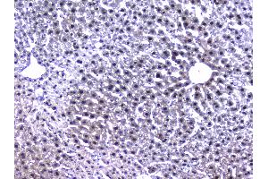 IHC analysis of RXRA using anti-RXRA antibody . (Retinoid X Receptor alpha 抗体  (AA 226-462))