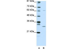 WB Suggested Anti-CRSP9 Antibody Titration:  0. (MED7 抗体  (N-Term))