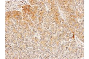IHC-P Image Immunohistochemical analysis of paraffin-embedded SW480 xenograft, using Seladin 1, antibody at 1:100 dilution. (Seladin 1 抗体)