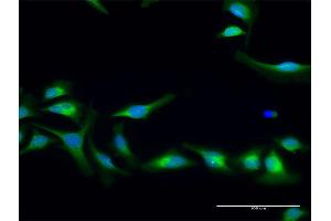 Immunofluorescence of purified MaxPab antibody to PLOD2 on HeLa cell. (PLOD2 抗体  (AA 1-758))