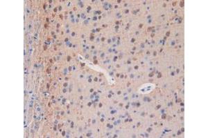 IHC-P analysis of Mouse Brain Tissue, with DAB staining. (PLA2R1 抗体  (AA 1418-1487))