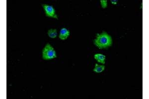 Immunofluorescence (IF) image for anti-Purinergic Receptor P2X, Ligand-Gated Ion Channel, 7 (P2RX7) (AA 110-247) antibody (ABIN7162449)