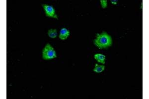 Immunofluorescence staining of Hela cells with ABIN7162449 at 1:100, counter-stained with DAPI. (P2RX7 抗体  (AA 110-247))