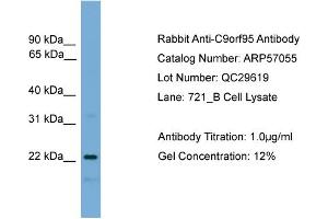 WB Suggested Anti-C9orf95  Antibody Titration: 0. (NMRK1 抗体  (N-Term))