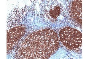 Pax-5 (clone 24) staining on human tonsil. (PAX5 抗体  (AA 151-306))