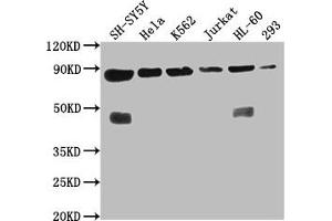 Western Blot Positive WB detected in: SH-SY5Y whole cell lysate, Hela whole cell lysate, K562 whole cell lysate, Jurkat whole cell lysate, HL60 whole cell lysate, 293 whole cell lysate All lanes: YY1AP1 antibody at 1:2000 Secondary Goat polyclonal to rabbit IgG at 1/50000 dilution Predicted band size: 88, 84, 82, 81, 76, 80, 51, 96, 98 kDa Observed band size: 88 kDa (YY1AP1 抗体  (AA 335-466))