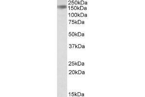 ABIN334479 (0. (DROSHA 抗体  (Internal Region))