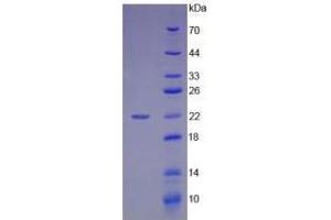 Image no. 1 for High Mobility Group Box 1 (HMGB1) (AA 9-163) (Active) protein (His tag) (ABIN6239874)