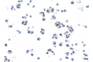 Immunocytochemistry (ICC) image for anti-Bromodomain Containing 3 (BRD3) (AA 676-726) antibody (ABIN7455203)
