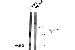 Western blots of rat kidney lysate showing specific immunolabeling of the ~ 29k and 37k glycosylated form of the AQP2 protein phosphorylated at Ser261. (AQP2 抗体  (pSer261))