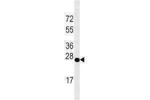 Western blot analysis of DDIT4 Antibody in Jurkat cell line lysates (35 μg/lane). (DDIT4 抗体)