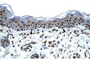 Immunohistochemical staining (Formalin-fixed paraffin-embedded sections) of human skin with IKZF5 polyclonal antibody  at 4-8 ug/mL working concentration. (IKZF5 抗体  (N-Term))