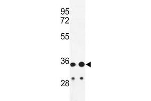 Western blot analysis of IGH antibody and HL-60, A2058 lysate. (IgH 抗体  (AA 290-320))