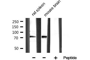 Western blot analysis of extracts of various sample,using MMP-9 Antibody. (MMP 9 抗体  (C-Term))