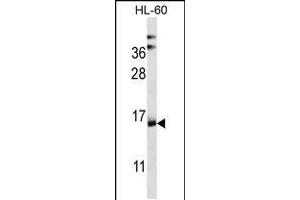 Western blot analysis in HL-60 cell line lysates (35ug/lane). (NDUFAF4 抗体  (N-Term))