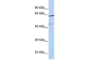 CCDC74A antibody used at 1 ug/ml to detect target protein. (CCDC74A 抗体  (Middle Region))