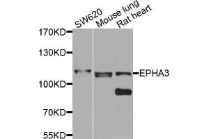 Western blot analysis of extracts of various cells, using EPHA3 antibody. (EPH Receptor A3 抗体)
