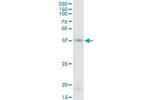 ACTB monoclonal antibody (M03), clone 1E7. (beta Actin 抗体  (AA 1-375))