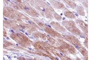 ABIN6267426 at 1/100 staining human Heart muscle tissue sections by IHC-P. (TNNI3 抗体  (pSer44))