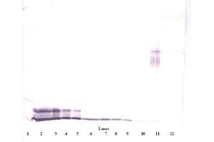 Image no. 4 for anti-Platelet Factor 4 (PF4) antibody (ABIN465152) (PF4 抗体)