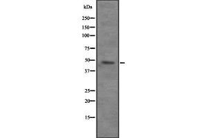 Western blot analysis of VPS4B expression in 293T whole cell lysate ,The lane on the left is treated with the antigen-specific peptide. (VPS4B 抗体  (Internal Region))