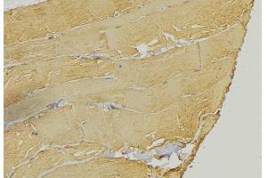 ABIN6274524 at 1/100 staining Mouse muscle tissue by IHC-P. (IARS2 抗体  (N-Term))