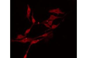 ABIN6274396 staining RAW264. (TTC23 抗体  (Internal Region))