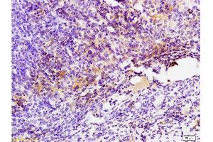 Formalin-fixed and paraffin embedded mouse colon carcinoma labeled with Anti-GPR49/LGR5 Polyclonal Antibody, Unconjugated  at 1:200 followed by conjugation to the secondary antibody and DAB staining. (LGR5 抗体  (AA 810-907))