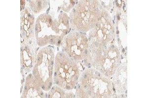 ABIN6277033 at 1/100 staining human kidney tissue sections by IHC-P. (PCK1 抗体  (C-Term))