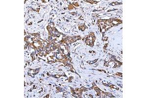 IHC analysis of RAB7/RAB7A using anti-RAB7/RAB7A antibody (ABIN7600597). (RAB7A 抗体  (AA 21-177))