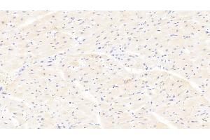 Detection of AMFR in Human Cardiac Muscle Tissue using Polyclonal Antibody to Autocrine Motility Factor Receptor (AMFR) (AMFR 抗体  (AA 456-643))