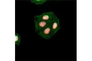 Immunofluorescence (IF) image for anti-H2A Histone Family, Member X (H2AFX) (pSer139) antibody (ABIN2666076) (H2AFX 抗体  (pSer139))