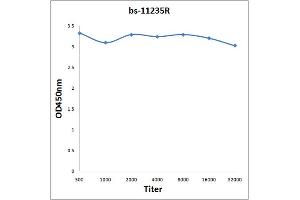 Antigen: 2 µg/100 µL Primary: Antiserum, 1:500, 1:1000, 1:2000, 1:4000, 1:8000, 1:16000, 1:32000; Secondary: HRP conjugated Rabbit Anti-Goat IgG at 1: 5000; TMB staining Read the data in Microplate Reader by 450nm. (GRK4/GRK5/GRK6 (AA 181-280) 抗体)