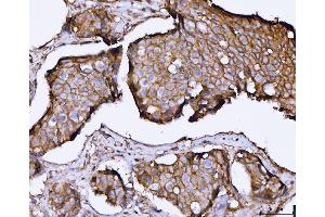 IHC analysis of SNAP23 using anti-SNAP23 antibody (ABIN7599089).